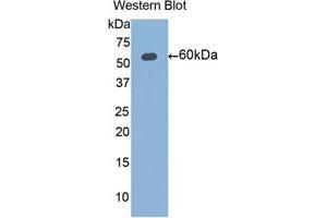 Western blot analysis of the recombinant protein. (ALDH7A1 Antikörper  (AA 1-539))