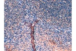 Immunohistochemistry (IHC) image for anti-Ubiquitin (Ub) (AA 1-229) antibody (ABIN7428593)