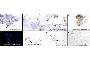 IHC Validation in COVID-19 Patient Sample: (Nuovo et al. (SARS-CoV-2 Envelope Antikörper  (N-Term))