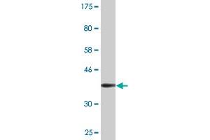 Western Blot detection against Immunogen (36. (PHOSPHO1 Antikörper  (AA 168-266))