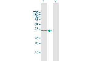 Western Blot analysis of PRMT6 expression in transfected 293T cell line by PRMT6 MaxPab polyclonal antibody. (PRMT6 Antikörper  (AA 1-316))