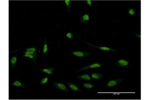 Immunofluorescence of monoclonal antibody to EIF4EBP3 on HeLa cell. (EIF4EBP3 Antikörper  (AA 1-100))