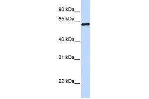 WB Suggested Anti-CSTF2 Antibody Titration:  0. (CSTF2 Antikörper  (N-Term))
