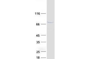 Western Blotting (WB) image for Baculoviral IAP Repeat Containing 3 (BIRC3) (Transcript Variant 2) protein (Myc-DYKDDDDK Tag) (ABIN2723207)