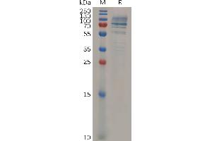 SDS-PAGE (SDS) image for Syndecan 1 (SDC1) (AA 23-254) protein (Fc Tag) (ABIN7092859)