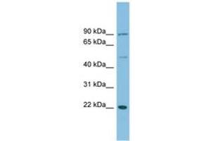 Image no. 1 for anti-DnaJ (Hsp40) Homolog, Subfamily C, Member 12 (DNAJC12) (C-Term) antibody (ABIN6745162) (DNAJC12 Antikörper  (C-Term))