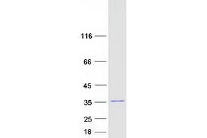 Western Blotting (WB) image for Inositol(myo)-1(or 4)-Monophosphatase 1 (IMPA1) (Transcript Variant 1) protein (Myc-DYKDDDDK Tag) (ABIN2723463)