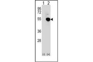 Western blot analysis of IRF4 (arrow) using IRF4 Antibody (Center) Cat.