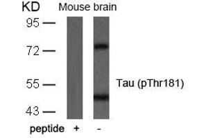 Western blot analysis of extracts from mouse brain tissue using Tau(Phospho-Thr181) Antibody and the same antibody preincubated with blocking peptide. (MAPT Antikörper  (pThr181))