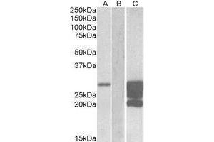 HEK293 lysate (10 µg protein in RIPA buffer) overexpressing Human GM2A with DYKDDDDK tag probed with AP23749PU-N (1. (GM2A Antikörper  (Internal Region))