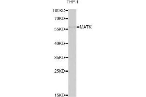 Western blot analysis of extracts of THP-1 cells, using MATK antibody. (MATK Antikörper)