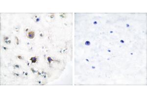 Peptide - +Immunohistochemical analysis of paraffin-embedded human brain tissue using Ephrin-B3 antibody (#C0182). (Ephrin B3 Antikörper)