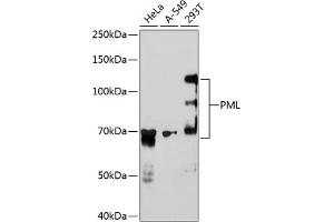 Western blot analysis of extracts of various cell lines, using PML antibody (ABIN7269565) at 1:1000 dilution. (PML Antikörper)