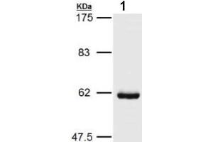 Western blot analysis of HSP60 expression in COLO205 cells (HSPD1 Antikörper)
