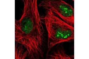 Immunofluorescent staining of human cell line U-2 OS with ADAR polyclonal antibody  at 1-4 ug/mL concentration shows positivity in nucleoli and nucleus but excluded from the nucleoli. (ADAR Antikörper)