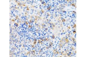 Immunohistochemistry (Paraffin-embedded Sections) (IHC (p)) image for anti-Chromatin Assembly Factor 1, Subunit B (p60) (CHAF1B) antibody (ABIN7011014)