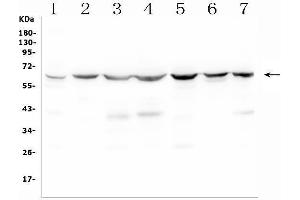 Western blot analysis of C9ORF72 using anti-C9ORF72 antibody (ABIN7603124).