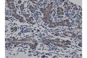 Immunohistochemical staining of paraffin-embedded Human breast tissue using anti-DNAJA2 mouse monoclonal antibody. (DNAJA2 Antikörper)