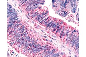Immunohistochemistry (IHC) image for anti-Cadherin EGF LAG Seven Pass G-Type Receptor 3 (CELSR3) (N-Term) antibody (ABIN1048436)