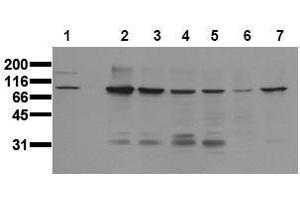 Western Blotting (WB) image for anti-Catenin (Cadherin-Associated Protein), beta 1, 88kDa (CTNNB1) (Core) antibody (ABIN126748) (CTNNB1 Antikörper  (Core))