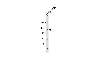 Anti-AD Antibody (Center) at 1:1000 dilution + human placenta lysate Lysates/proteins at 20 μg per lane. (ADAM19 Antikörper  (AA 207-236))