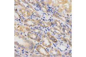 Immunohistochemistry of paraffin-embedded human kidney using ITGB5 antibody at dilution of 1:200 (x400 lens) (Integrin beta 5 Antikörper  (AA 490-720))