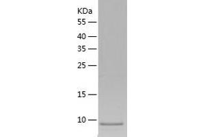 Western Blotting (WB) image for Chemokine (C Motif) Ligand 1 (XCL1) (AA 22-114) protein (His tag) (ABIN7122258)