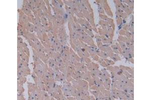 Immunohistochemistry (IHC) image for anti-serpin Peptidase Inhibitor, Clade A (Alpha-1 Antiproteinase, Antitrypsin), Member 6 (SERPINA6) (AA 173-344) antibody (ABIN7428320)