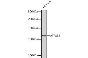 Western blot analysis of extracts of HCT116 cells, using B3 Rabbit pAb (ABIN7265751) at 1:1000 dilution. (ATP8B3 Antikörper  (AA 600-900))
