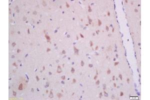 Formalin-fixed and paraffin embedded rat brain labeled with Anti-GHRH Polyclonal Antibody (ABIN726275) at 1:300 followed by conjugation to the secondary antibody and DAB staining.