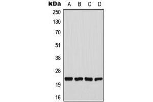 Western blot analysis of CHAC1 expression in U2OS (A), HeLa (B), Raw264. (CHAC1 Antikörper  (N-Term))