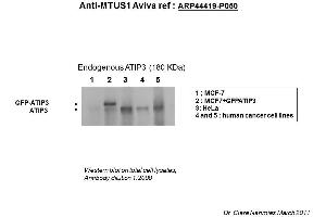 Image no. 2 for anti-Microtubule Associated Tumor Suppressor 1 (MTUS1) (Middle Region) antibody (ABIN502510) (MTUS1 Antikörper  (Middle Region))