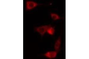 ABIN6275056 staining NIH-3T3 cells by IF/ICC. (DHPS Antikörper  (Internal Region))