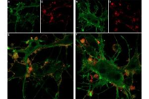 Live cell imaging of Hm1a-ATTO Fluor-647N in differentiated  cells.