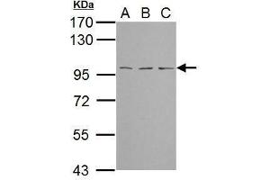WB Image Sample (30 ug of whole cell lysate) A: NIH-3T3 B: JC C: BCL-1 7. (TBCK Antikörper)