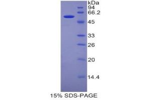 SDS-PAGE (SDS) image for Pregnancy Zone Protein (PZP) (AA 1224-1495) protein (His tag,GST tag) (ABIN2123496)