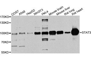 Western blot analysis of extracts of various cell lines, using STAT3 antibody. (STAT3 Antikörper)