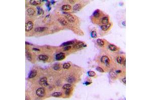 Immunohistochemistry (IHC) image for anti-c-Fos (c-Fos) (C-Term), (pSer362) antibody (ABIN7300696)