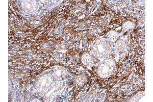 IHC-P Image ITI-H3 antibody [N1N3] detects ITI-H3 protein at secreted on mouse cervix by immunohistochemical analysis. (ITIH3 Antikörper)