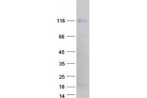 Validation with Western Blot