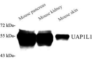 Western blot analysis of UAP1L1 (ABIN7076143) at dilution of 1: 2000 (UAP1L1 Antikörper)