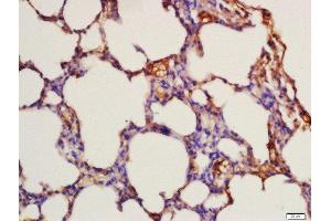 Formalin-fixed and paraffin embedded rat lung labeled with Rabbit Anti-FLT3 (Tyr842) Polyclonal Antibody, Unconjugated  at 1:200 followed by conjugation to the secondary antibody and DAB staining (FLT3 Antikörper  (pTyr842))