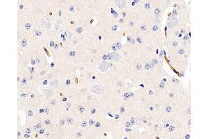 Immunohistochemistry analysis of paraffin-embedded Mouse brain using AQP1 Polyclonal Antibody at dilution of 1:400. (Aquaporin 1 Antikörper)