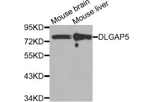 Western blot analysis of extracts of various tissues, using DLGAP5 antibody. (DLGAP5 Antikörper  (AA 547-846))