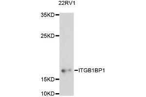 Western blot analysis of extracts of 22RV1 cells, using ITGB1BP1 antibody (ABIN6290512) at 1:3000 dilution. (ITGB1BP1 Antikörper)