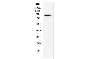 Western blot analysis of SEMA3E using anti-SEMA3E antibody (ABIN6719619).