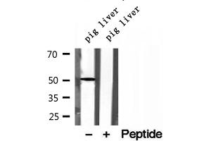 anti-Nuclear Receptor Subfamily 1, Group H, Member 2 (NR1H2) (Internal Region) antibody