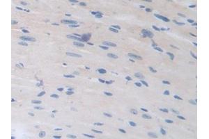Immunohistochemistry (IHC) image for anti-Heparanase (HPSE) (AA 353-464) antibody (ABIN7438439)