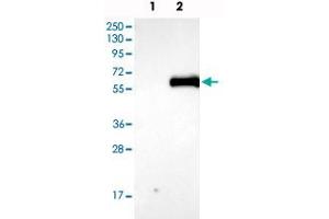 Western blot analysis of Lane 1: Negative control (vector only transfected HEK293T lysate), Lane 2: Over-expression Lysate (Co-expressed with a C-terminal myc-DDK tag (~3. (AGT Antikörper)