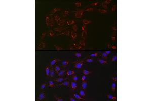 Immunofluorescence analysis of U2OS cells using  Rabbit mAb (ABIN7265367) at dilution of 1:100 (40x lens). (ACAA2 Antikörper)
